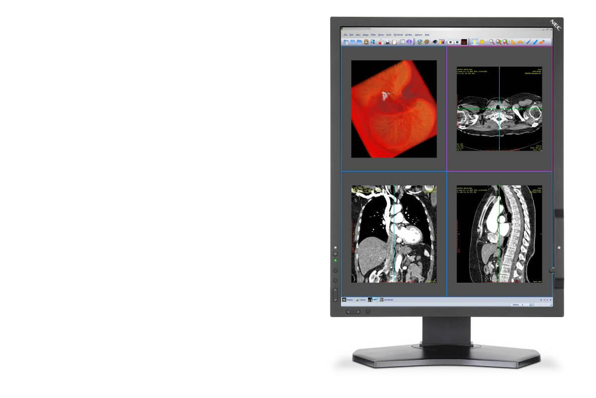 La medicina tiene nueva imagen, NEC lanza monitores dedicados al diagnóstico