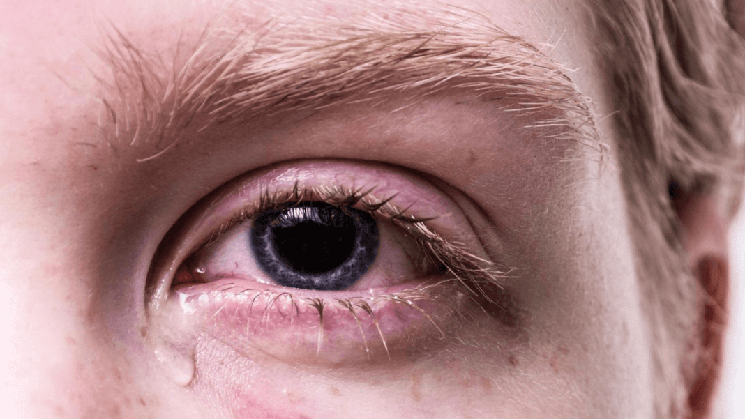 ojo de color azul llorando